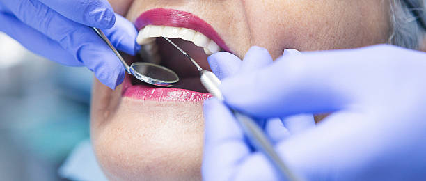 Best Emergency Dental Care for Broken or Chipped Teeth in Tyro, NC
